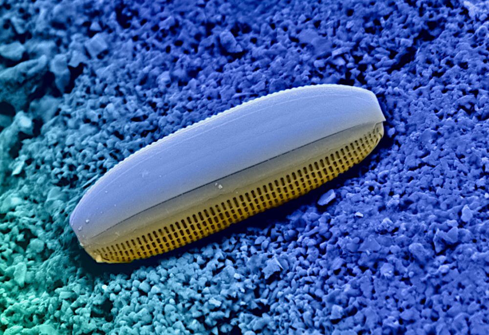 Diatomée observée au microscope électronique à balayage (MEB)